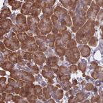 KIAA1143 Antibody in Immunohistochemistry (Paraffin) (IHC (P))