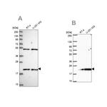 KIAA1143 Antibody in Western Blot (WB)