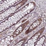 ANKRD17 Polyclonal Antibody