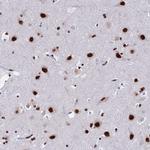 SF3B2 Antibody in Immunohistochemistry (Paraffin) (IHC (P))