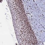 SF3B2 Antibody in Immunohistochemistry (Paraffin) (IHC (P))