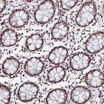 SF3B2 Antibody in Immunohistochemistry (Paraffin) (IHC (P))