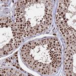 SF3B2 Antibody in Immunohistochemistry (Paraffin) (IHC (P))
