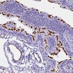 EVI2A Antibody in Immunohistochemistry (Paraffin) (IHC (P))