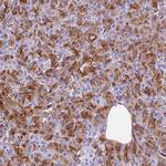 EVI2A Polyclonal Antibody