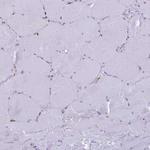 EVI2A Antibody in Immunohistochemistry (Paraffin) (IHC (P))