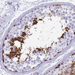 EVI2A Antibody in Immunohistochemistry (Paraffin) (IHC (P))