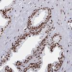 PCDHB11 Antibody in Immunohistochemistry (Paraffin) (IHC (P))