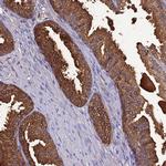 OR56B1 Antibody in Immunohistochemistry (Paraffin) (IHC (P))