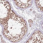 NBPF4 Antibody in Immunohistochemistry (Paraffin) (IHC (P))
