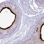 SMIM24 Antibody in Immunohistochemistry (IHC)