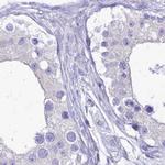 SMIM24 Antibody in Immunohistochemistry (IHC)
