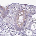 SMIM24 Antibody in Immunohistochemistry (IHC)