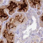 SMIM24 Antibody in Immunohistochemistry (IHC)
