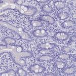 CLEC2L Antibody in Immunohistochemistry (Paraffin) (IHC (P))