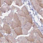 CLEC2L Antibody in Immunohistochemistry (Paraffin) (IHC (P))