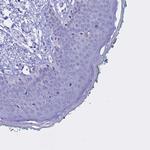 CLEC2L Antibody in Immunohistochemistry (Paraffin) (IHC (P))