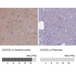 CLEC2L Antibody in Immunohistochemistry (IHC)