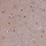 CLEC2L Antibody in Immunohistochemistry (IHC)