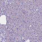 CLEC2L Antibody in Immunohistochemistry (IHC)