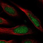 CCDC127 Polyclonal Antibody