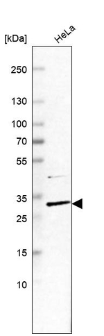 CCDC127 Antibody in Western Blot (WB)