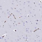 Ninjurin 1 Antibody in Immunohistochemistry (Paraffin) (IHC (P))
