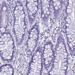 Ninjurin 1 Antibody in Immunohistochemistry (Paraffin) (IHC (P))