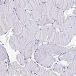 Ninjurin 1 Antibody in Immunohistochemistry (Paraffin) (IHC (P))