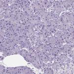 PTGES Antibody in Immunohistochemistry (Paraffin) (IHC (P))