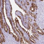 PTGES Antibody in Immunohistochemistry (IHC)