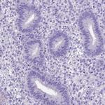 PTGES Antibody in Immunohistochemistry (IHC)