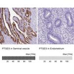 PTGES Antibody