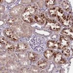 CEACAM16 Polyclonal Antibody