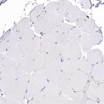 HM13 Antibody in Immunohistochemistry (Paraffin) (IHC (P))