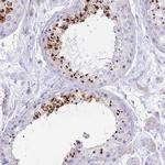 LRRC37A2 Antibody in Immunohistochemistry (Paraffin) (IHC (P))