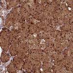 ZNF619 Antibody in Immunohistochemistry (Paraffin) (IHC (P))