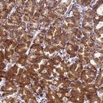 EEF1D Polyclonal Antibody