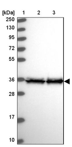 EEF1D Antibody in Western Blot (WB)