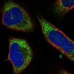 C7orf28A Polyclonal Antibody