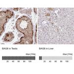 BAG6 Antibody in Immunohistochemistry (IHC)