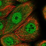 CCDC112 Polyclonal Antibody