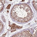 CCDC112 Antibody in Immunohistochemistry (Paraffin) (IHC (P))