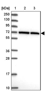 CCDC112 Antibody in Western Blot (WB)
