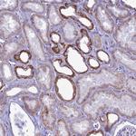 C21orf140 Polyclonal Antibody