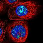 OSER1 Polyclonal Antibody