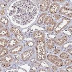 OSER1 Antibody in Immunohistochemistry (Paraffin) (IHC (P))