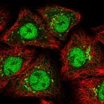 ZMIZ1 Polyclonal Antibody