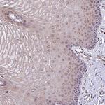 POLR2I Antibody in Immunohistochemistry (Paraffin) (IHC (P))