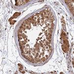 UBE2W Polyclonal Antibody